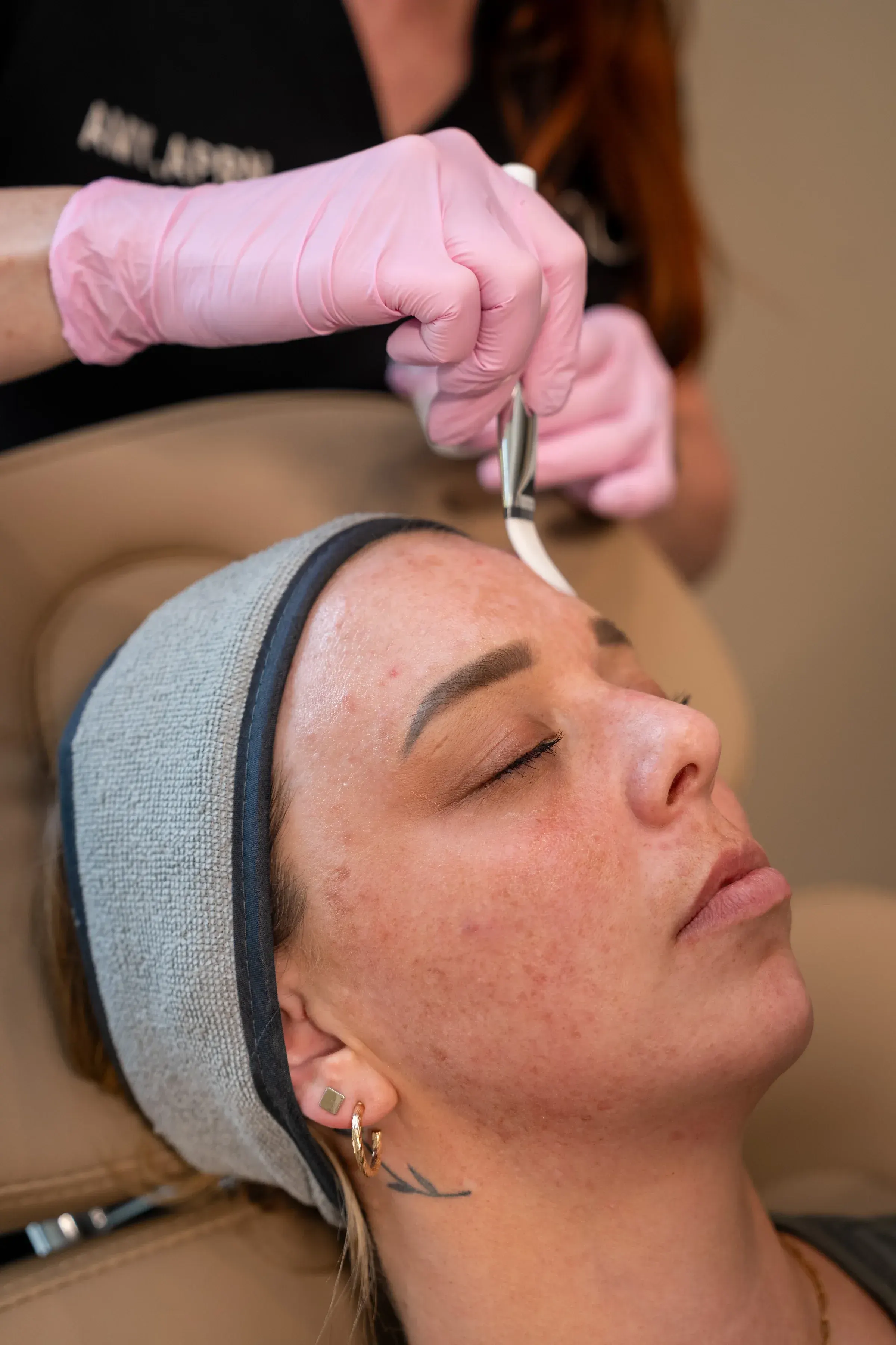 Chemical peel solution application technique demonstration