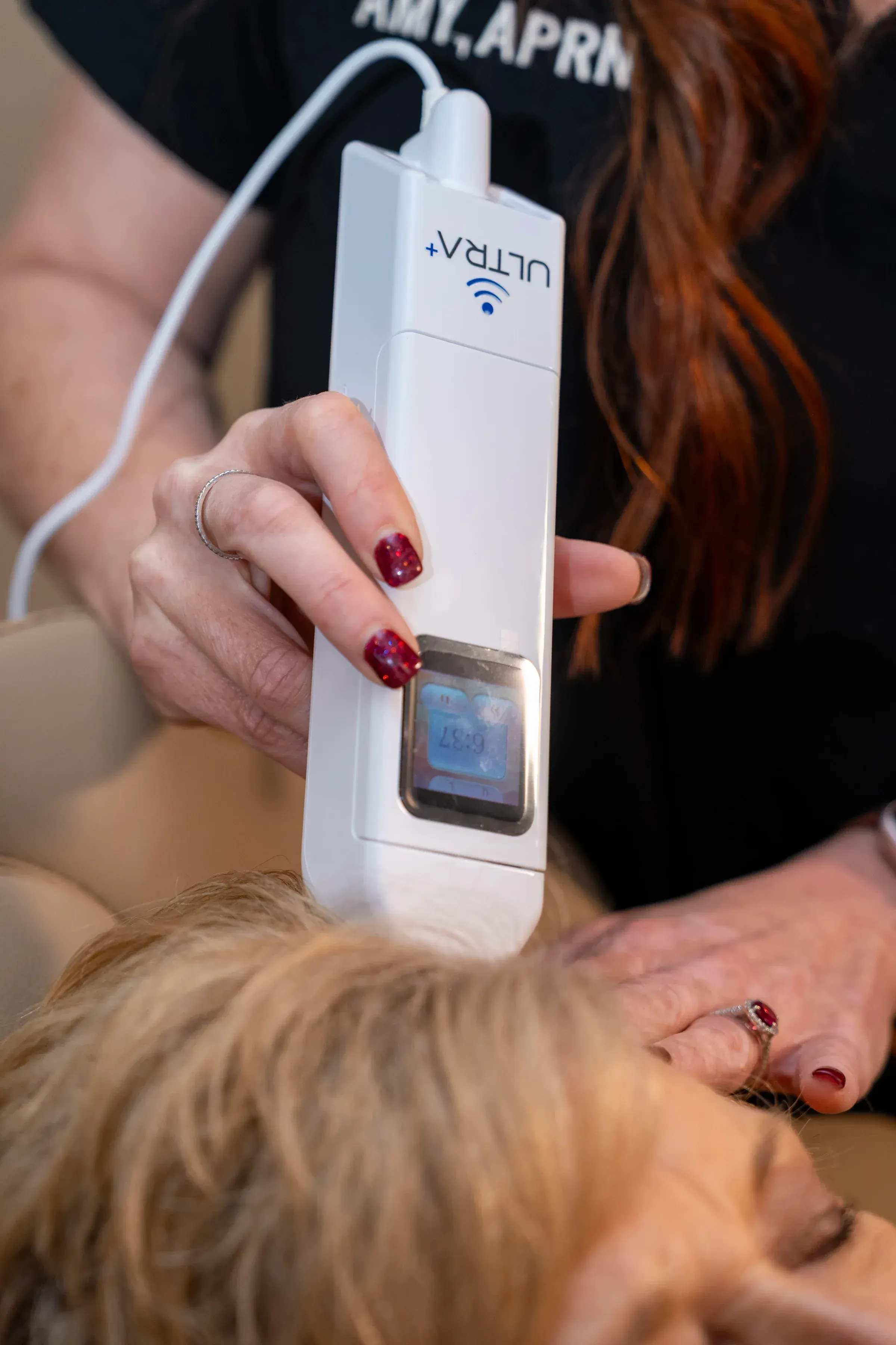 Hair restoration treatment equipment and process