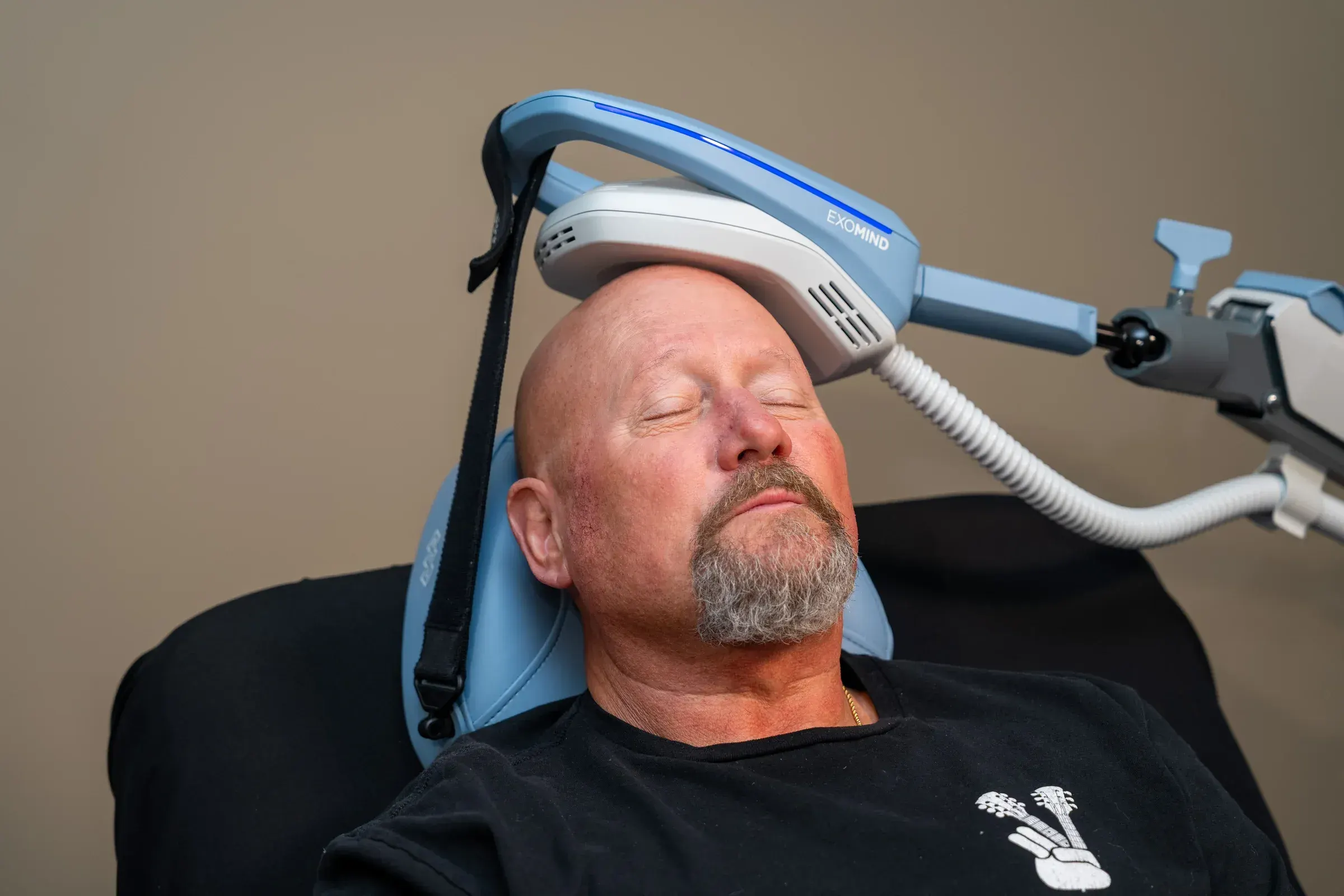 Exomind TMS Therapy
