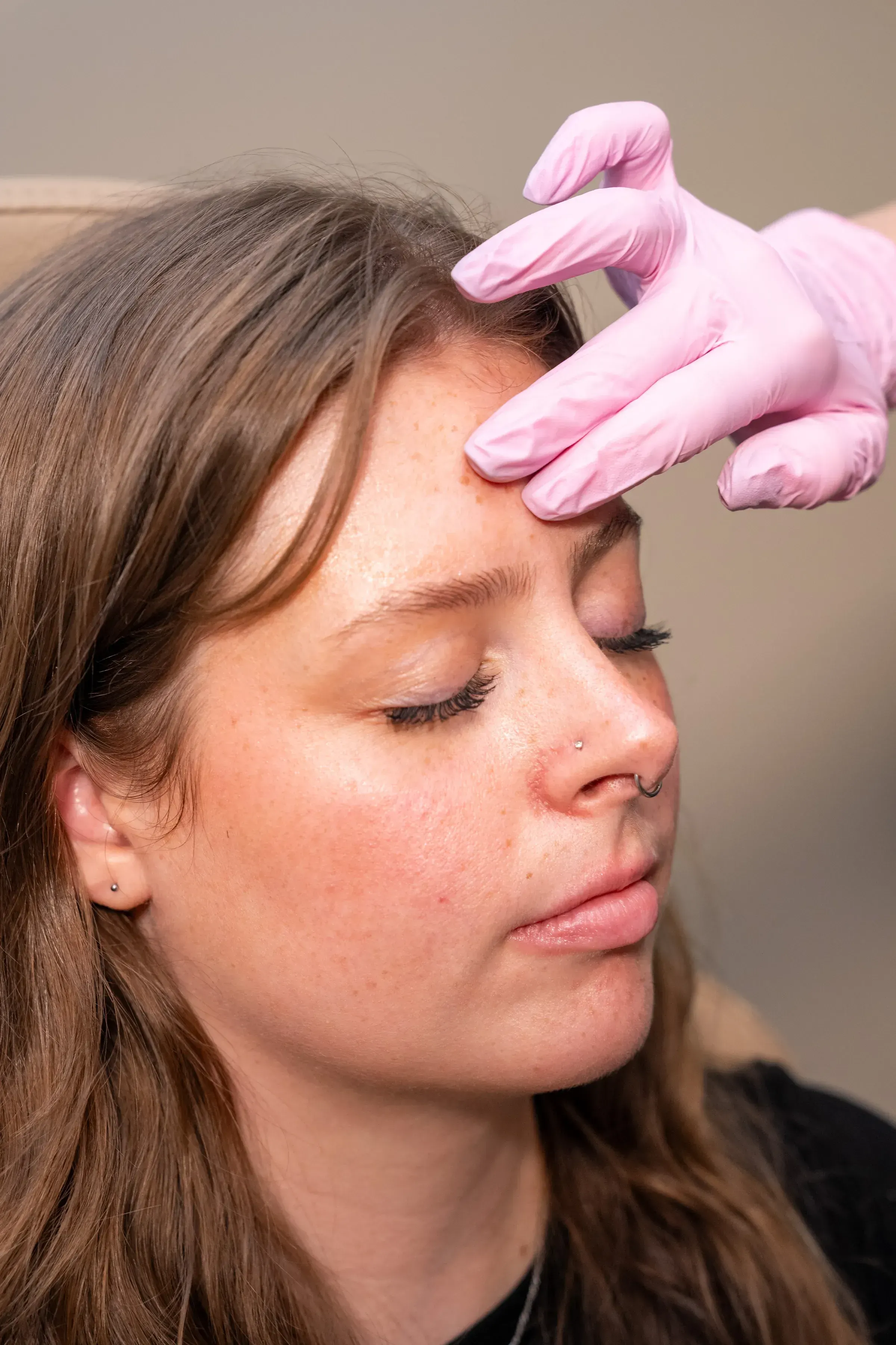 Medical-grade skincare products and treatment tools