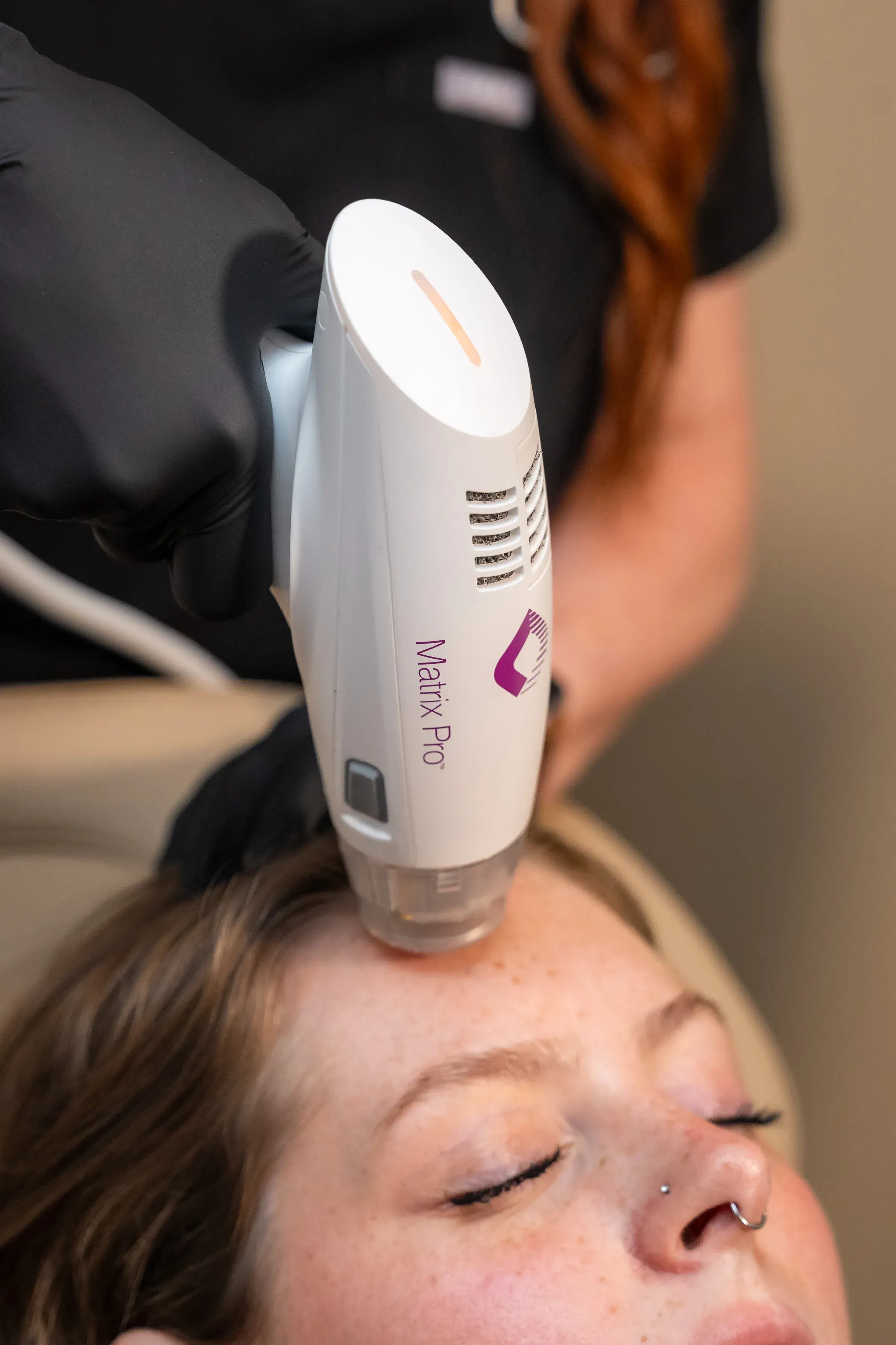 Confident patient considering RF Microneedling