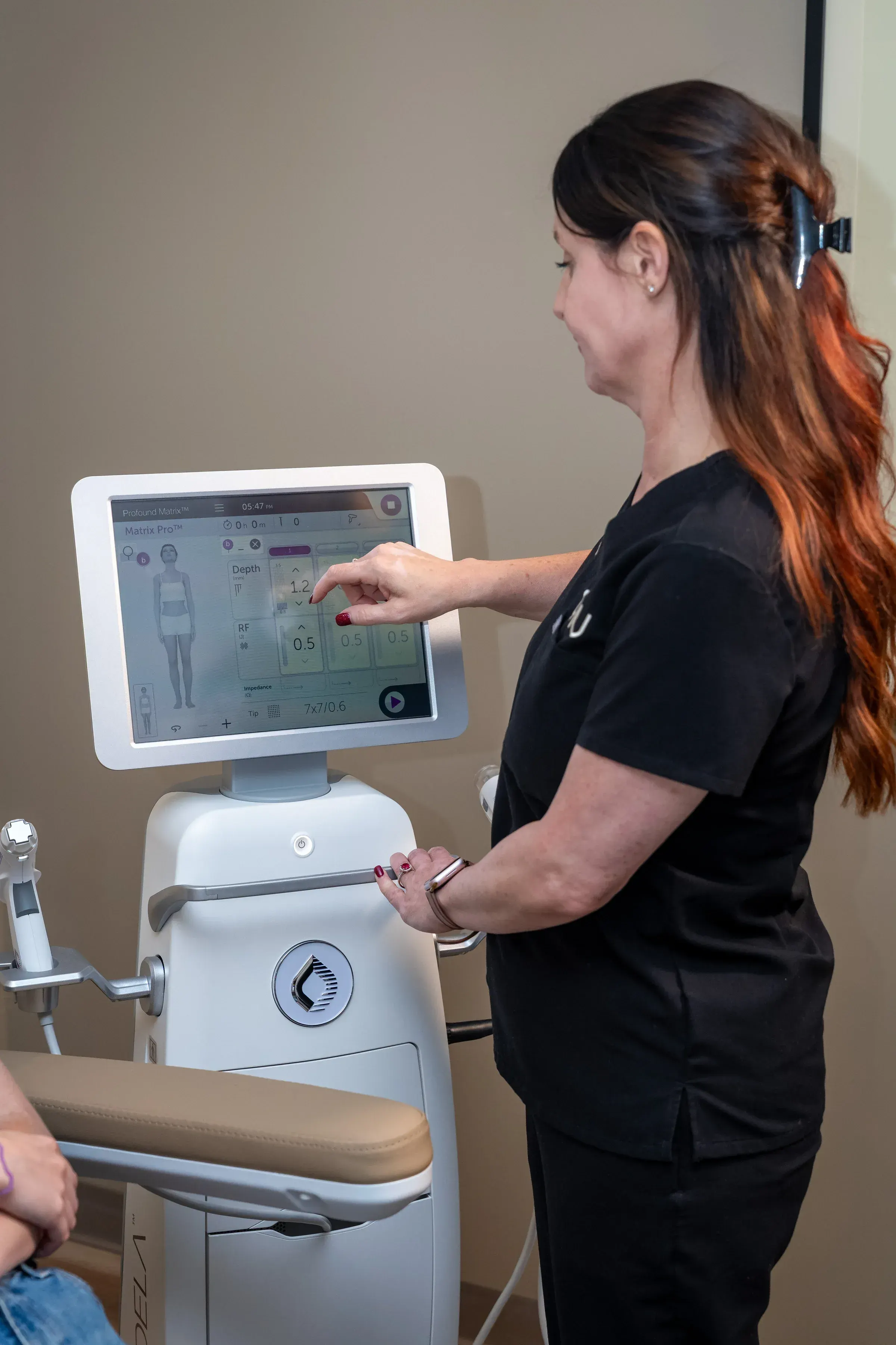 RF Microneedling device and treatment process