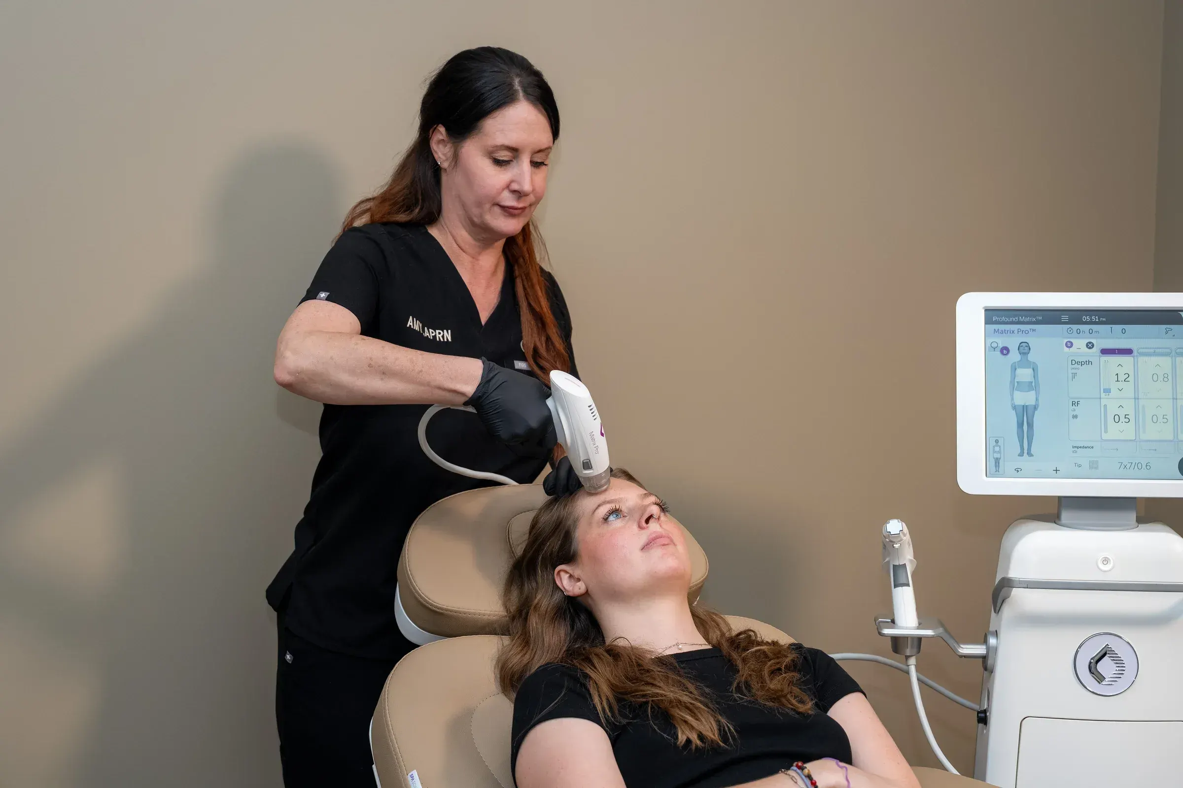 RF Microneedling