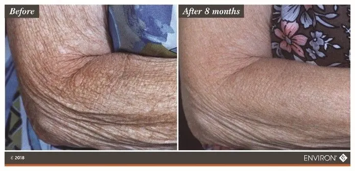 skincare Environ effect on skin