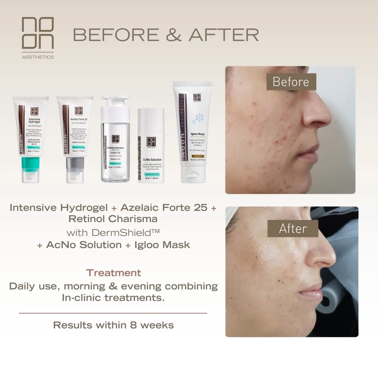 skincare Noon Aesthetics effect on skin