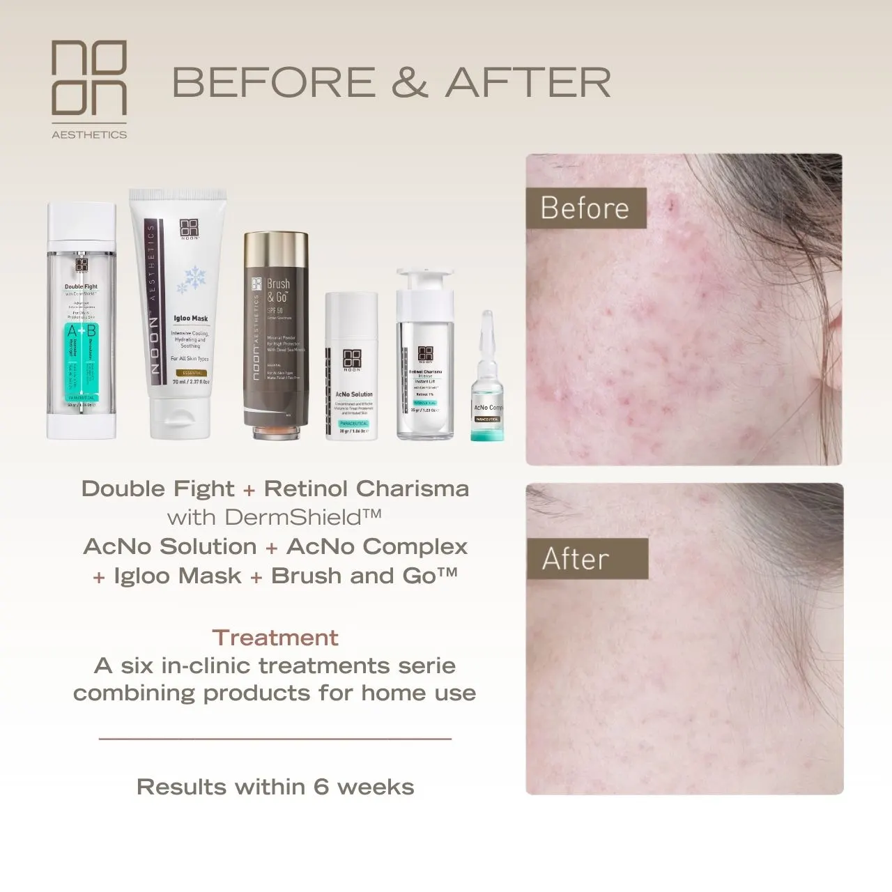 skincare Noon Aesthetics effect on skin