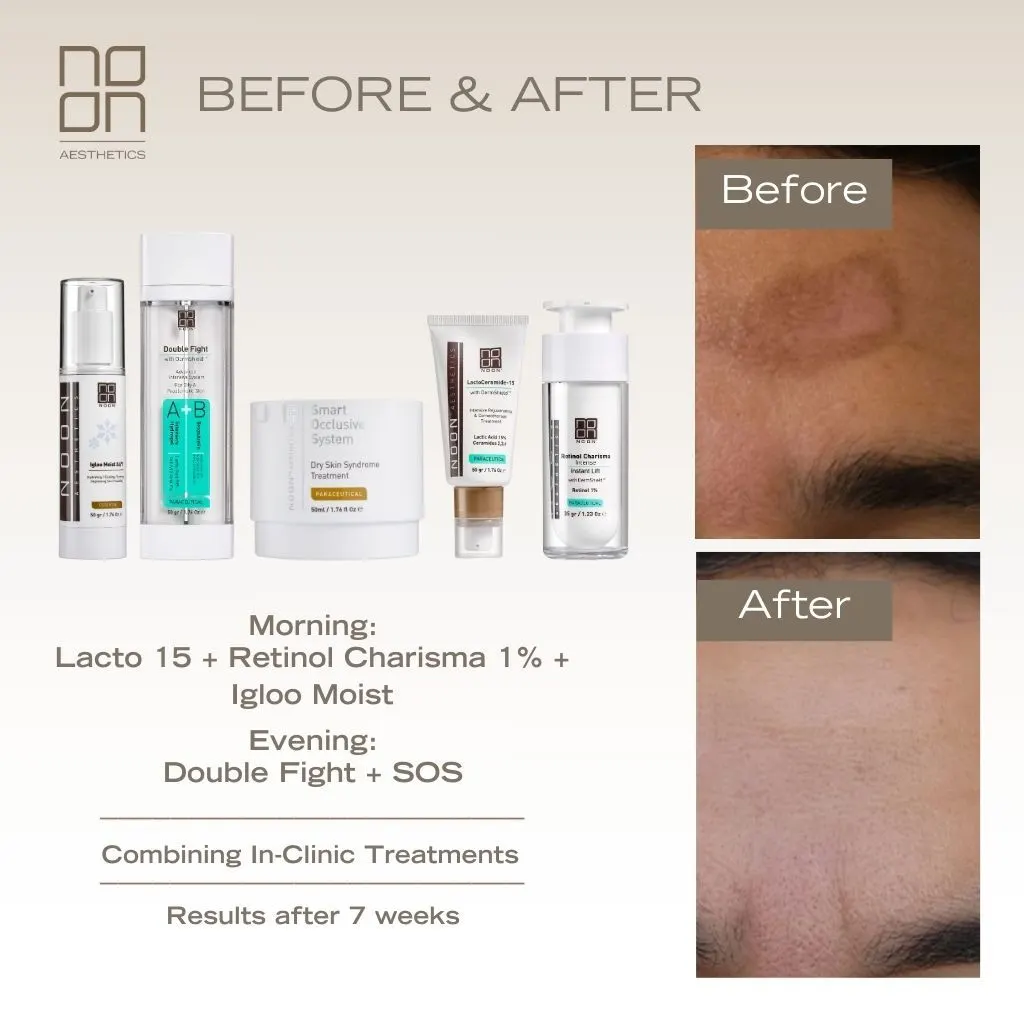 skincare Noon Aesthetics effect on skin