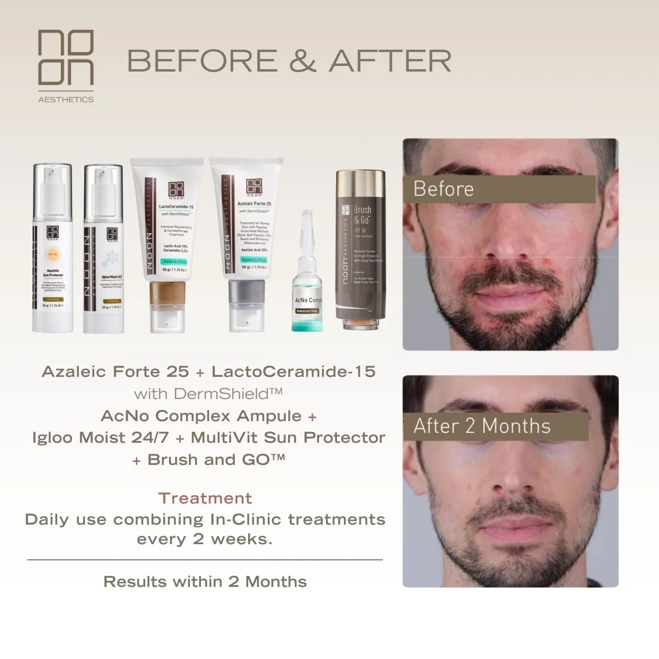 skincare Noon Aesthetics effect on skin