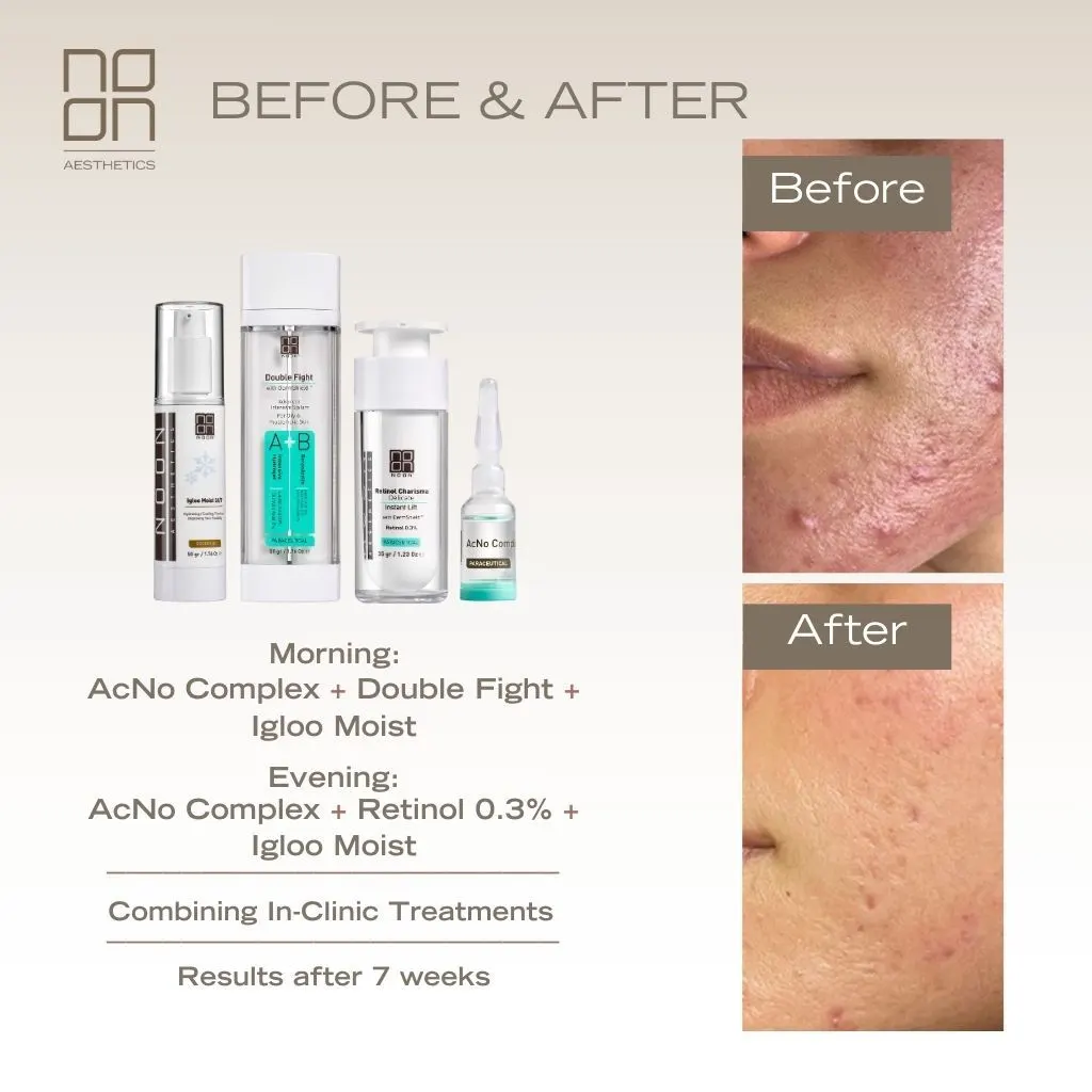 skincare Noon Aesthetics effect on skin