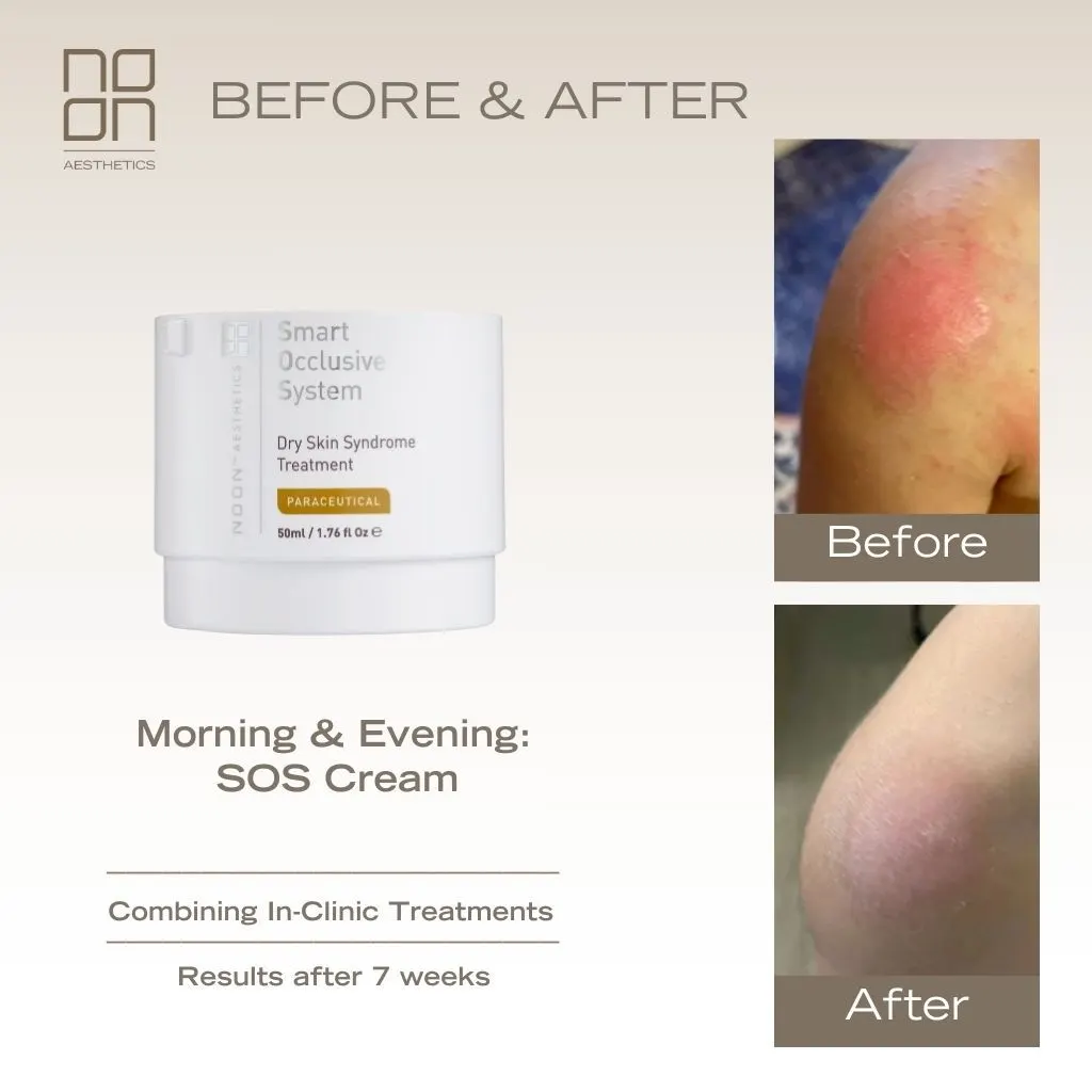 skincare Noon Aesthetics effect on skin