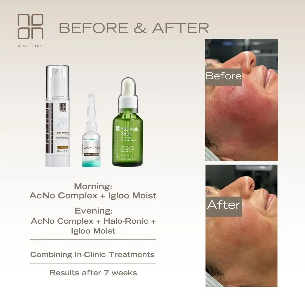 skincare Noon Aesthetics effect on skin