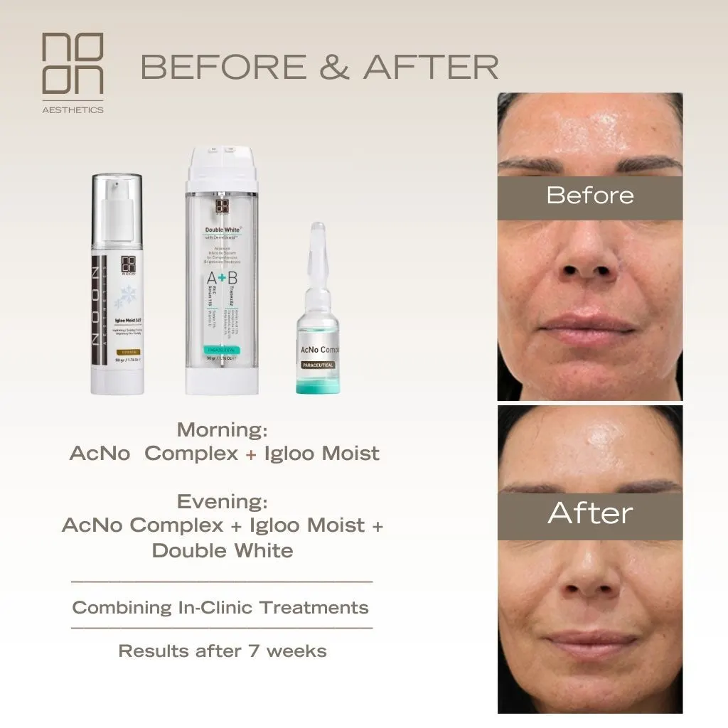 skincare Noon Aesthetics effect on skin