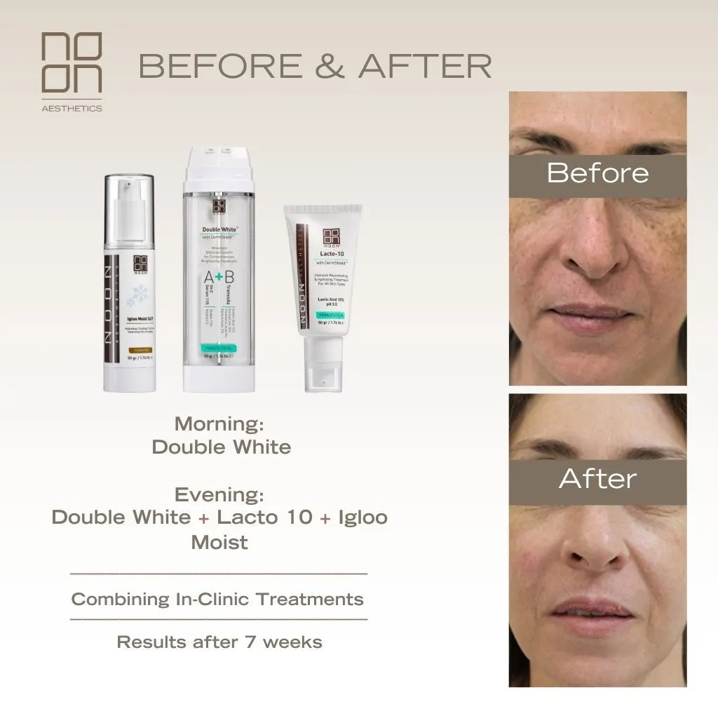 skincare Noon Aesthetics effect on skin
